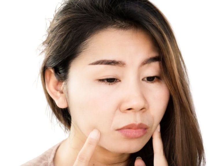 Understanding and Treating Accordion Lines Around the Mouth