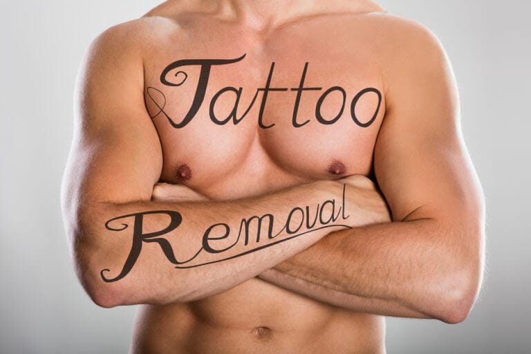 How Does Tattoo Removal Work?
